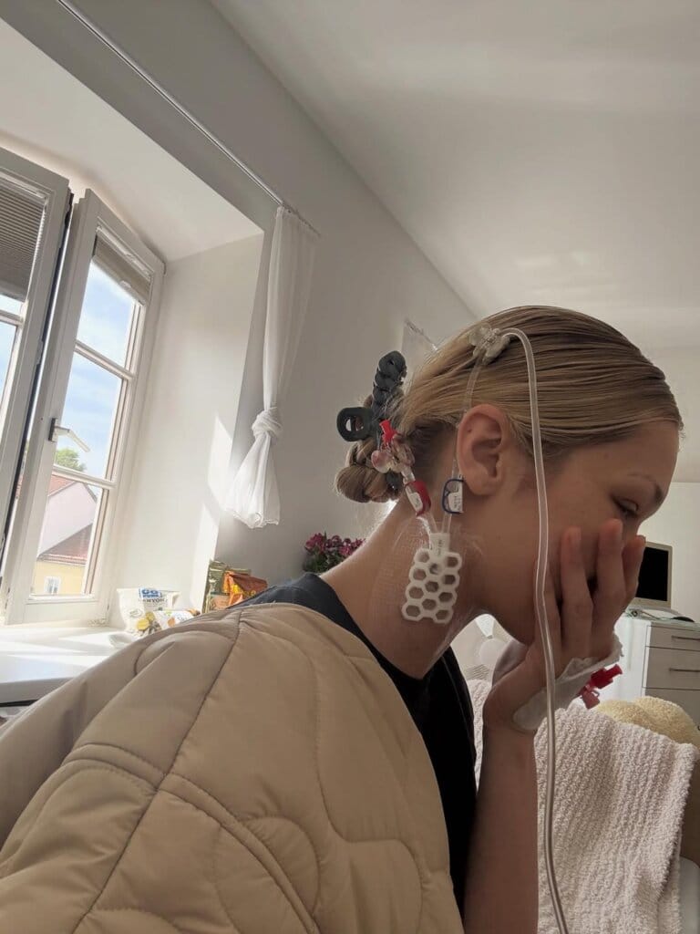 ما هو مرض بيلا حديد؟