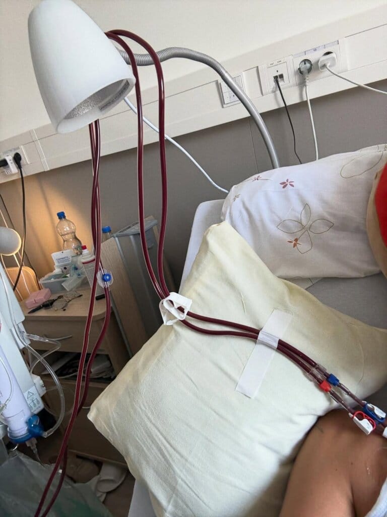 ما هو مرض بيلا حديد؟