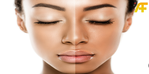 طريقة تفتيح البشرة السمراء خلال 7 أيام: خطواب يومية ووصفات مجربة