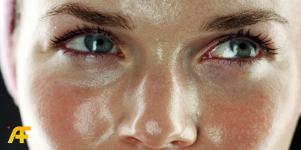 أفضل روتين عناية بالبشرة الدهنية المعرضة لحب الشباب