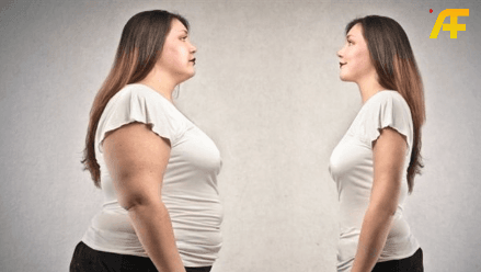السمنة لدى النساء