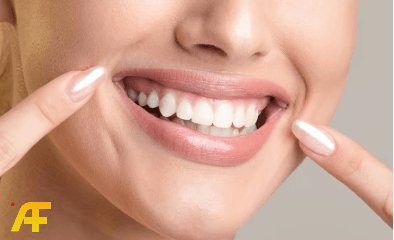 طريقة تبييض الأسنان في يوم واحد