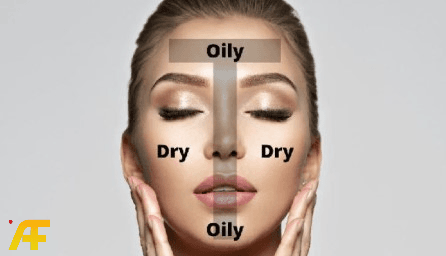 عيوب ومميزات البشرة المختلطة