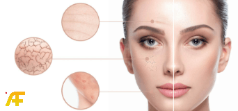 كيفية استخدام الكولاجين السائل للبشرة بطريقة صحيحة