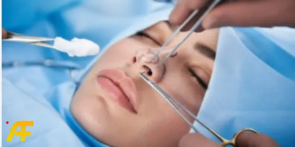 أفضل نصائح قبل عملية تجميل الأنف حسب توصيات جراحي التجميل والتجارب السابقة