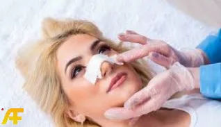 تعليمات قبل عملية تجميل الأنف