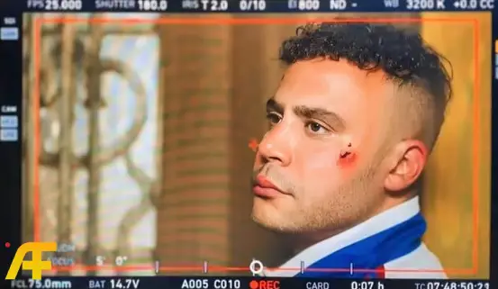 ما هي تفاصيل سقوط محمد إمام أثناء تصوير مسلسل الكينج 2026؟