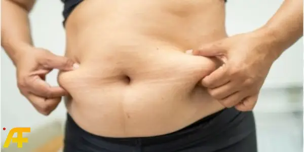 أسباب تراكم دهون البطن السفلية وكيفية إزالتها بشكل نهائي