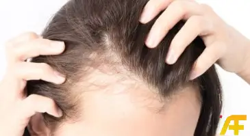 وصفة لتكثيف الشعر الخفيف وملء الفراغات